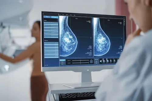 Mamografi Taramasını Atlamak Hayati Risk Oluşturabiliyor!