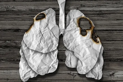 Akciğer Kanseri Tanısı Aldıktan Sonra Bile Sigarayı Bırakmak, Yaşam Süresini Etkiliyor